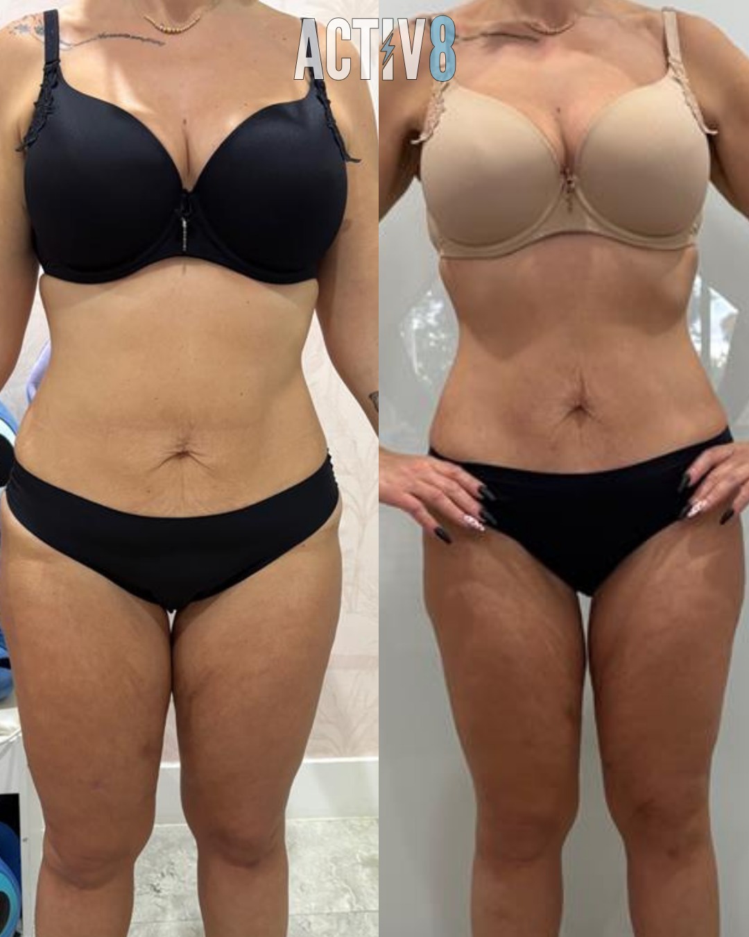 Client transformation